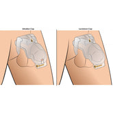 Custom Lockdown Locking Customizable Chastity Cage - Clear
